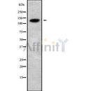 Western blot analysis of CATSPERB using COLO205 whole cell lysates