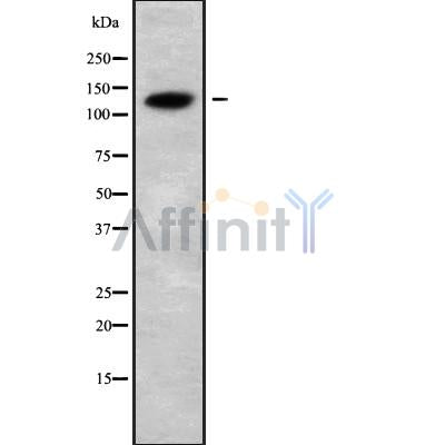 Western blot analysis of CATSPERB using COLO205 whole cell lysates
