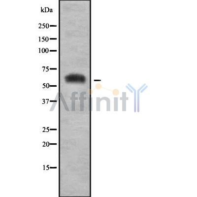 Western blot analysis of extracts from various samples, using SLC7A3 Antibody.
 Lane 1: HepG2 treated with blocking peptide.
 Lane 2: HepG2;
 Lane 3: mouse brain;
 