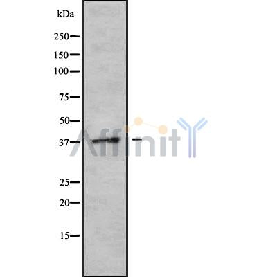 Western blot analysis of CGRRF1 using K562 whole cell lysates