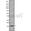 Western blot analysis of CRABP1 using COLO205 whole cell lysates