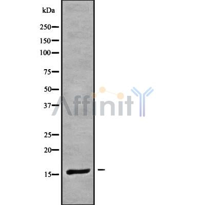 Western blot analysis of CRABP1 using COLO205 whole cell lysates