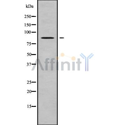 Western blot analysis of ACAP2 using K562 whole cell lysates
