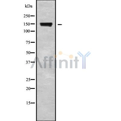 DF9366 at 1/100 staining Human brain cancer tissue by IHC-P. The sample was formaldehyde fixed and a heat mediated antigen retrieval step in citrate buffer was performed. The sample was then blocked and incubated with the antibody for 1.5 hours at 22¡ãC. An HRP conjugated goat anti-rabbit antibody was used as the secondary