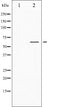 AF3100 staining Hela by IF/ICC. The sample were fixed with PFA and permeabilized in 0.1% Triton X-100,then blocked in 10% serum for 45 minutes at 25¡ãC. The primary antibody was diluted at 1/200 and incubated with the sample for 1 hour at 37¡ãC. An  Alexa Fluor 594 conjugated goat anti-rabbit IgG (H+L) Ab, diluted at 1/600, was used as the secondary antibod