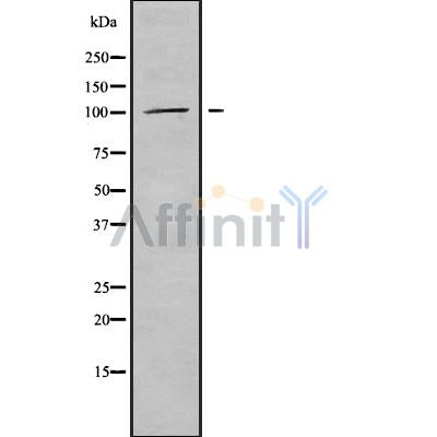 Western blot analysis of extracts from rat muscle and mouse brain, using PDE2A Antibody.