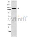 Western blot analysis of PDE3B using HuvEc whole cell lysates
