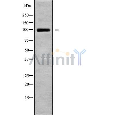 Western blot analysis of PDE5A using HuvEc whole cell lysates