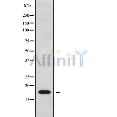 DF9374 at 1/100 staining Mouse testis tissue by IHC-P. The sample was formaldehyde fixed and a heat mediated antigen retrieval step in citrate buffer was performed. The sample was then blocked and incubated with the antibody for 1.5 hours at 22¡ãC. An HRP conjugated goat anti-rabbit antibody was used as the secondary