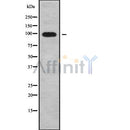 Western blot analysis of CLCN2 using K562 whole cell lysates