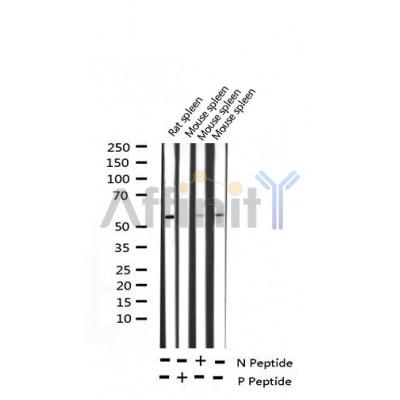 AF3101 staining Jurkat cells by ICC/IF. Cells were fixed with PFA and permeabilized in 0.1% saponin prior to blocking in 10% serum for 45 minutes at 37¡ãC. The primary antibody was diluted 1/400 and incubated with the sample for 1 hour at 37¡ãC. A  Alexa Fluor? 594 conjugated goat polyclonal to rabbit IgG (H+L), diluted 1/600 was used as secondary antibod