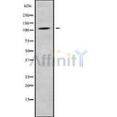 Western blot analysis of CLCN1 using K562 whole cell lysates