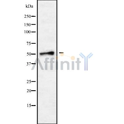 Western blot analysis SLC18A1 using LOVO whole cell lysates