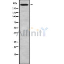 Western blot analysis of CHD6 using MCF7 whole cell lysates