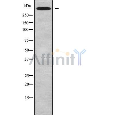 Western blot analysis of CHD6 using MCF7 whole cell lysates