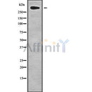 Western blot analysis of extracts from rat brain, using CHD8 Antibody. Lane 1 was treated with the blocking peptide.