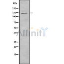 DF9385 at 1/100 staining Mouse lung tissue by IHC-P. The sample was formaldehyde fixed and a heat mediated antigen retrieval step in citrate buffer was performed. The sample was then blocked and incubated with the antibody for 1.5 hours at 22¡ãC. An HRP conjugated goat anti-rabbit antibody was used as the secondary