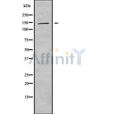 DF9385 at 1/100 staining Mouse lung tissue by IHC-P. The sample was formaldehyde fixed and a heat mediated antigen retrieval step in citrate buffer was performed. The sample was then blocked and incubated with the antibody for 1.5 hours at 22¡ãC. An HRP conjugated goat anti-rabbit antibody was used as the secondary