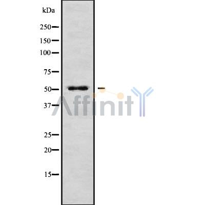 Western blot analysis of LUC7L3 using Jurkat whole cell lysates