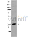 Western blot analysis of CMTM5 using HeLa whole cell lysates