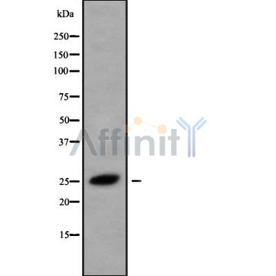 Western blot analysis of CMTM5 using HeLa whole cell lysates