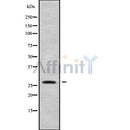 Western blot analysis of CLDN12 using K562 whole cell lysates