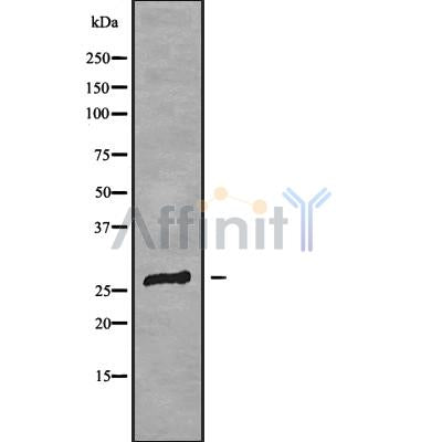 Western blot analysis of extracts from various samples, using CLDN18 Antibody.
 Lane 1: COS-7, treated with blocking peptide;
 Lane 2: COS-7;
 Lane 3: 3T3.