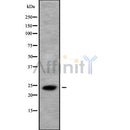 Western blot analysis of extracts from HepG2 and rat muscle , using CLDN22/24 Antibody.