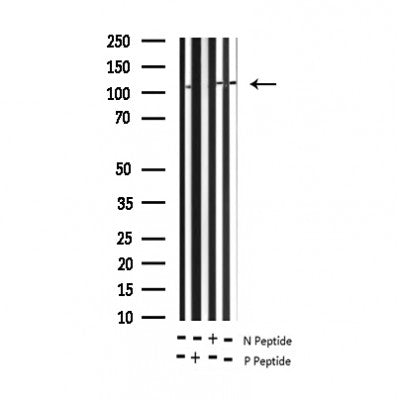 AF3103 staining MOLT by IF/ICC. The sample were fixed with PFA and permeabilized in 0.1% Triton X-100,then blocked in 10% serum for 45 minutes at 25¡ãC. The primary antibody was diluted at 1/200 and incubated with the sample for 1 hour at 37¡ãC. An  Alexa Fluor 594 conjugated goat anti-rabbit IgG (H+L) Ab, diluted at 1/600, was used as the secondary antibod