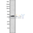 Western blot analysis of extracts from mouse brain, using CCDC109A Antibody. Lane 1 was treated with the blocking peptide.