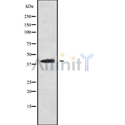 Western blot analysis of extracts from mouse brain, using CCDC109A Antibody. Lane 1 was treated with the blocking peptide.