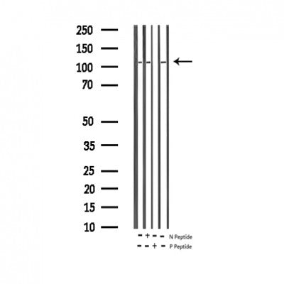 AF3104 staining MOLT by IF/ICC. The sample were fixed with PFA and permeabilized in 0.1% Triton X-100,then blocked in 10% serum for 45 minutes at 25¡ãC. The primary antibody was diluted at 1/200 and incubated with the sample for 1 hour at 37¡ãC. An  Alexa Fluor 594 conjugated goat anti-rabbit IgG (H+L) Ab, diluted at 1/600, was used as the secondary antibod