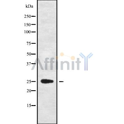 Western blot analysis of extracts from mouse brain, using C1QL4 Antibody. Lane 1 was treated with the blocking peptide.