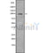DF9410 at 1/100 staining Mouse kidney tissue by IHC-P. The sample was formaldehyde fixed and a heat mediated antigen retrieval step in citrate buffer was performed. The sample was then blocked and incubated with the antibody for 1.5 hours at 22¡ãC. An HRP conjugated goat anti-rabbit antibody was used as the secondary