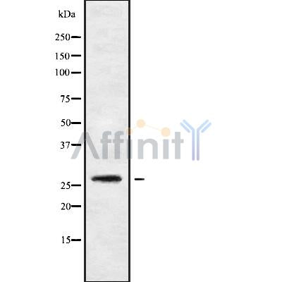 Western blot analysis of CFD using K562 whole cell lysates