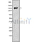 Western blot analysis NCAPD3 using LOVO whole cell lysates