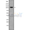 Western blot analysis of CNTN3 using COLO205 whole cell lysates