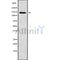 Western blot analysis of extracts from HUVEC, using CNTNAP3 Antibody. Lane 1 was treated with the blocking peptide.