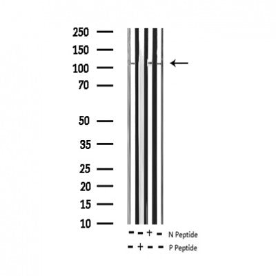AF3105 staining MOLT by IF/ICC. The sample were fixed with PFA and permeabilized in 0.1% Triton X-100,then blocked in 10% serum for 45 minutes at 25¡ãC. The primary antibody was diluted at 1/200 and incubated with the sample for 1 hour at 37¡ãC. An  Alexa Fluor 594 conjugated goat anti-rabbit IgG (H+L) Ab, diluted at 1/600, was used as the secondary antibod