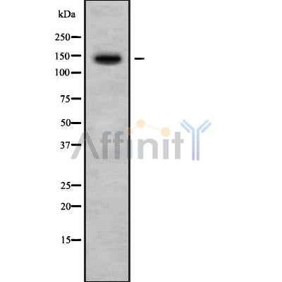 Western blot analysis of extracts from Mouse brain, using CNTNAP4 Antibody. Lane 1 was treated with the blocking peptide.