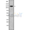 Western blot analysis of extracts from Mouse brain, using CNTNAP4 Antibody. Lane 1 was treated with the blocking peptide.
