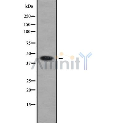 Western blot analysis of HSD11B2 using COLO205 whole cell lysates