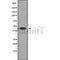Western blot analysis of HSD11B2 using COLO205 whole cell lysates