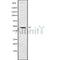 Western blot analysis of CTH using HuvEc whole cell lysates