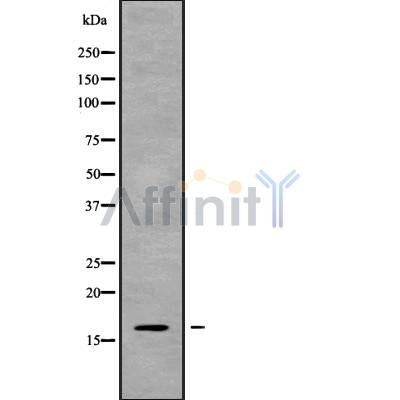 Western blot analysis of CST8 using Jurkat whole cell lysates