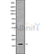 Western blot analysis of CST8 using Jurkat whole cell lysates