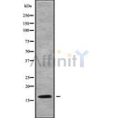 DF9425 at 1/100 staining Human Melanoma tissue by IHC-P. The sample was formaldehyde fixed and a heat mediated antigen retrieval step in citrate buffer was performed. The sample was then blocked and incubated with the antibody for 1.5 hours at 22¡ãC. An HRP conjugated goat anti-rabbit antibody was used as the secondary