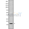 DF9426 at 1/100 staining Human Melanoma tissue by IHC-P. The sample was formaldehyde fixed and a heat mediated antigen retrieval step in citrate buffer was performed. The sample was then blocked and incubated with the antibody for 1.5 hours at 22¡ãC. An HRP conjugated goat anti-rabbit antibody was used as the secondary