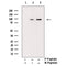 AF3106 staining COS7 by IF/ICC. The sample were fixed with PFA and permeabilized in 0.1% Triton X-100,then blocked in 10% serum for 45 minutes at 25¡ãC. The primary antibody was diluted at 1/200 and incubated with the sample for 1 hour at 37¡ãC. An  Alexa Fluor 594 conjugated goat anti-rabbit IgG (H+L) Ab, diluted at 1/600, was used as the secondary antibod