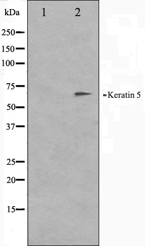 Western blot analysis on HepG2 cell lysate using Keratin 5 Antibody. The lane on the left is treated with the antigen-specific peptide.